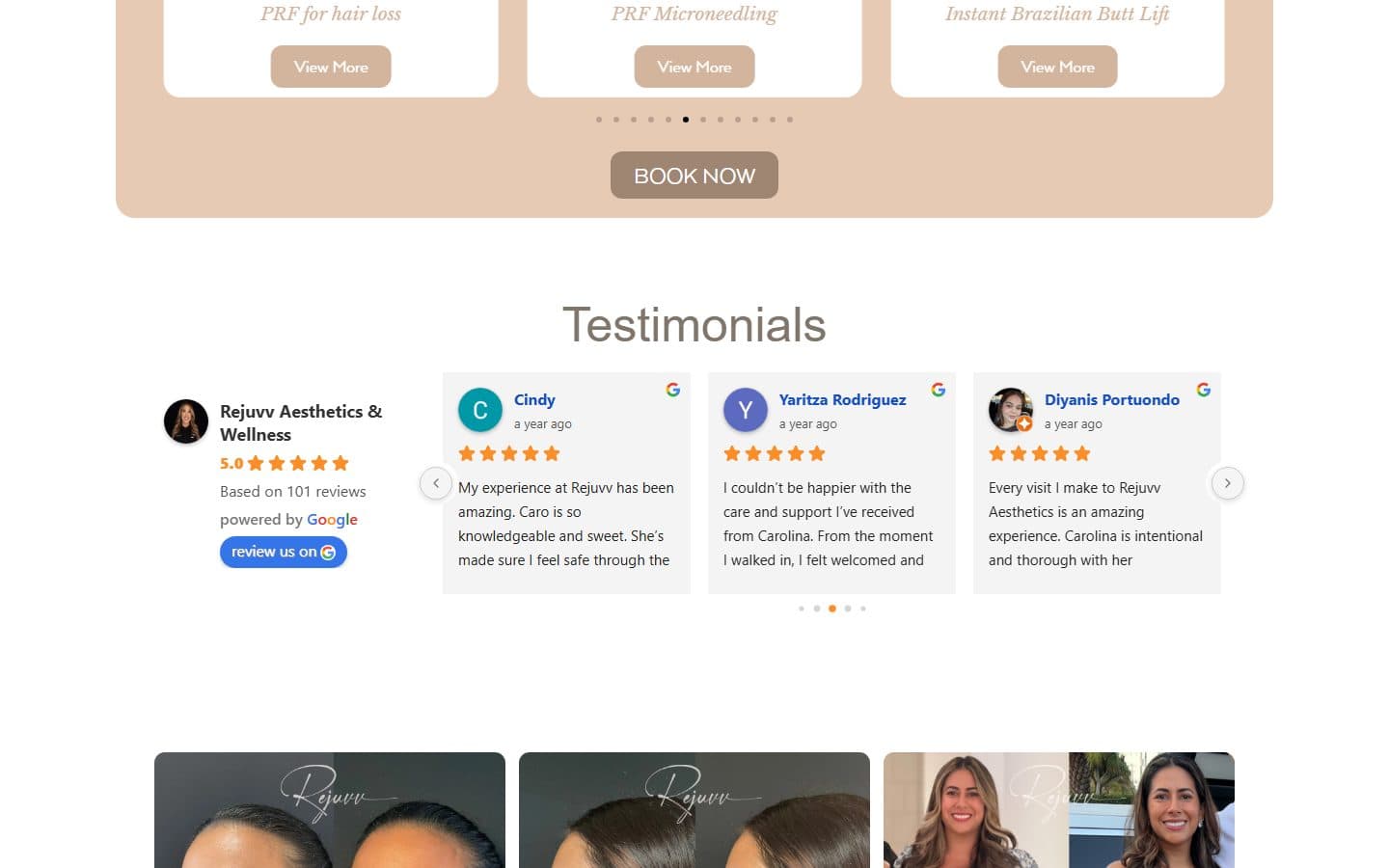 Rejuvv Aesthetics & Wellness website, section 2